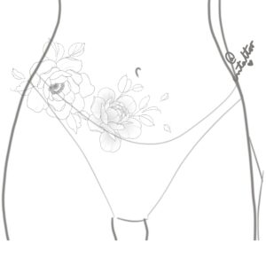 Proyecto abdomen-4